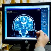 Tens of thousands of people missed out on potentially life-saving scans like MRI and CT tests across the country this year. Photo: Getty Images