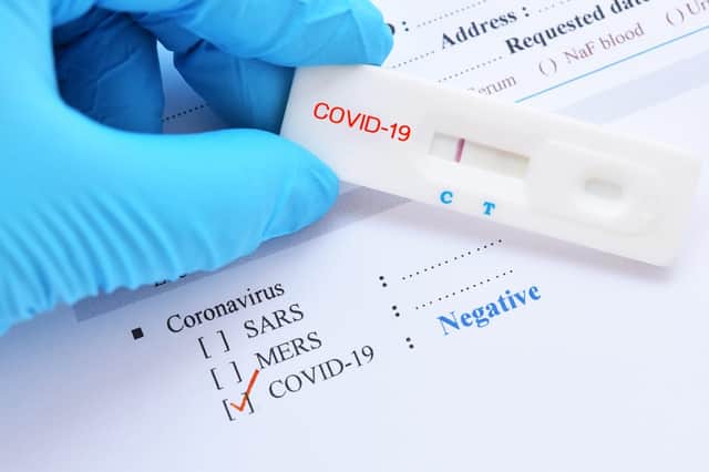 Everything you need to know about the new test for coronavirus (Photo: Shutterstock)