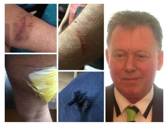 Nigel Carr suffered bite marks and grazes to his arms and legs in the attack