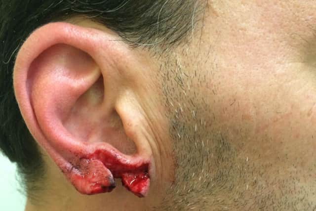 Ricky Power's bloody ear straight after assault. Â© SWNS.com